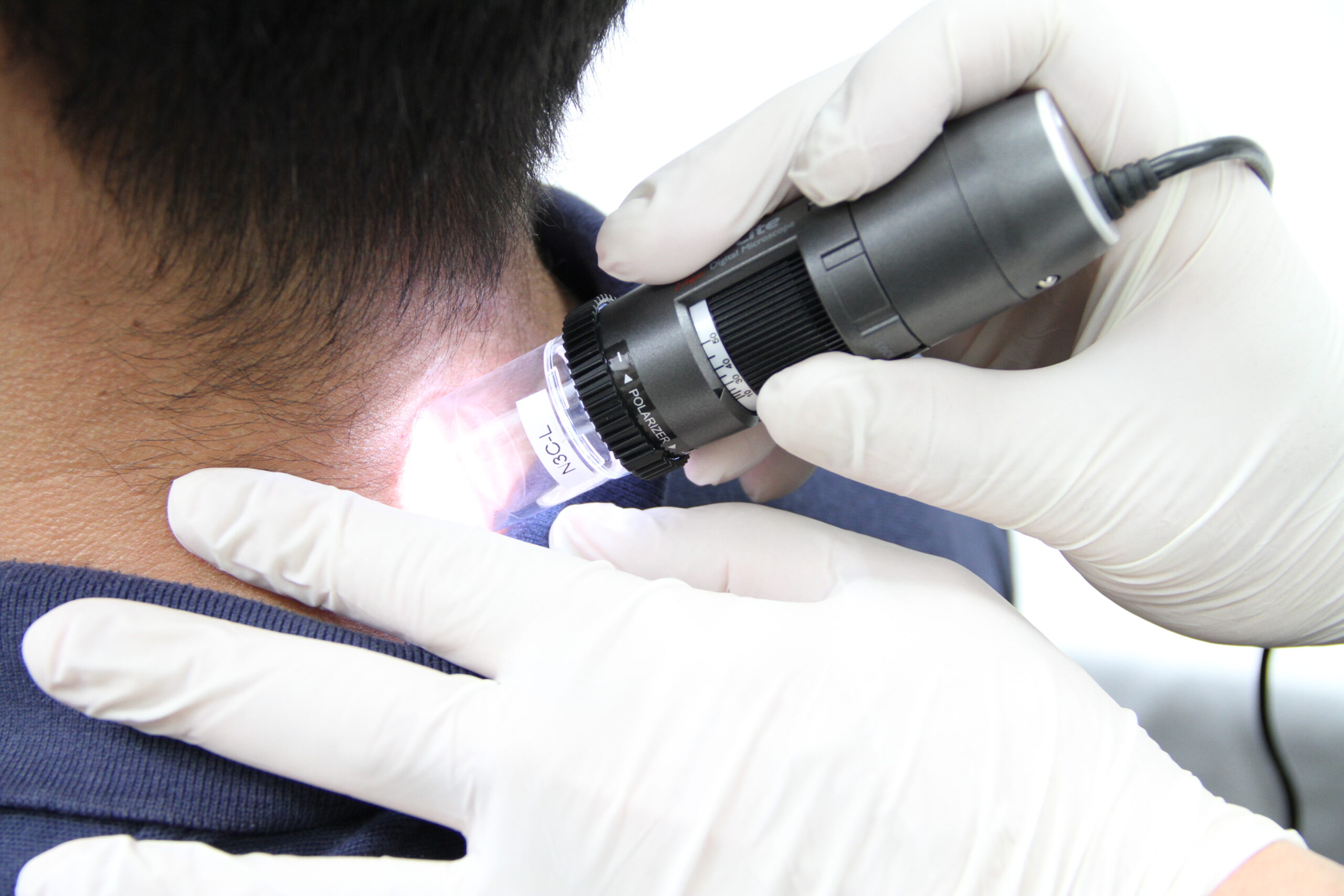 Dino-Lite Dermascope® polarizer (MEDL4DW) - Afbeelding 9